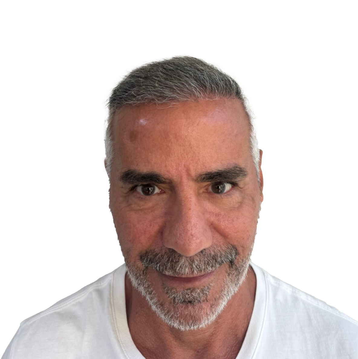 Carlos — Depois